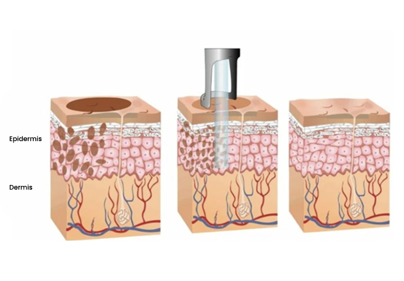 M-Aesthetic Pico Laser & Gold Toning Laser diagram